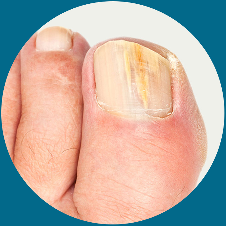 Supination - Davenport House Clinic